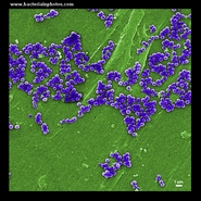 staphylococcus aureus micrograph